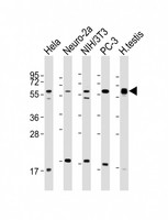 TRXR1 / TXNRD1 Antibody - All lanes: Anti-TXNRD1 Antibody (C-Term) at 1:2000 dilution Lane 1: Hela whole cell lysate Lane 2: Neuro-2a whole cell lysate Lane 3: NIH/3T3 whole cell lysate Lane 4: PC-3 whole cell lysate Lane 5: human testis lysate Lysates/proteins at 20 µg per lane. Secondary Goat Anti-Rabbit IgG, (H+L), Peroxidase conjugated at 1/10000 dilution. Predicted band size: 71 kDa Blocking/Dilution buffer: 5% NFDM/TBST.