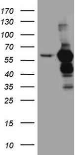 TRXR1 / TXNRD1 Antibody - HEK293T cells were transfected with the pCMV6-ENTRY control. (Left lane) or pCMV6-ENTRY TXNRD1. (Right lane) cDNA for 48 hrs and lysed. Equivalent amounts of cell lysates. (5 ug per lane) were separated by SDS-PAGE and immunoblotted with anti-TXNRD1. (1:2000)
