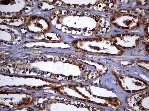 TRXR1 / TXNRD1 Antibody - Immunohistochemical staining of paraffin-embedded Human Kidney tissue within the normal limits using anti-TXNRD1 mouse monoclonal antibody. (Heat-induced epitope retrieval by 1mM EDTA in 10mM Tris buffer. (pH8.5) at 120°C for 3 min. (1:2000)