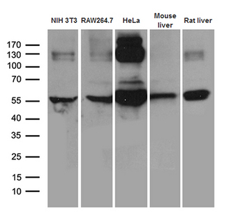 TRXR1 / TXNRD1 Antibody - Western blot analysis of extracts. (35ug) from 3 different cell lines and 2 different tissue lysates by using anti-TXNRD1 monoclonal antibody. (1:500)