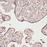 TRXR1 / TXNRD1 Antibody - Immunohistochemistry of paraffin-embedded Human placenta using TXNRD1 Polyclonal Antibody at dilution of 1:100 (40x lens).