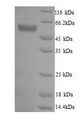 TPR Protein - (Tris-Glycine gel) Discontinuous SDS-PAGE (reduced) with 5% enrichment gel and 15% separation gel.