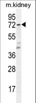 TS / Thromboxane Synthase Antibody - CYP5A1 Antibody western blot of mouse kidney tissue lysates (35 ug/lane). The CYP5A1 antibody detected the CYP5A1 protein (arrow).