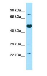 TS / Thromboxane Synthase Antibody - TS / Thromboxane Synthase antibody Western Blot of Fetal Brain.  This image was taken for the unconjugated form of this product. Other forms have not been tested.
