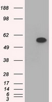 TS / Thromboxane Synthase Antibody - HEK293T cells were transfected with the pCMV6-ENTRY control (Left lane) or pCMV6-ENTRY TBXAS1 (Right lane) cDNA for 48 hrs and lysed. Equivalent amounts of cell lysates (5 ug per lane) were separated by SDS-PAGE and immunoblotted with anti-TBXAS1.