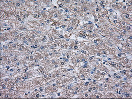TS / Thromboxane Synthase Antibody - Immunohistochemical staining of paraffin-embedded Human liver tissue using anti-TBXAS1 mouse monoclonal antibody. (Dilution 1:50).