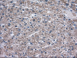 TS / Thromboxane Synthase Antibody - Immunohistochemical staining of paraffin-embedded Human liver tissue using anti-TBXAS1 mouse monoclonal antibody. (Dilution 1:50).
