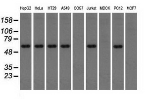 TS / Thromboxane Synthase Antibody - Western blot of extracts (35 ug) from 9 different cell lines by using anti-TBXAS1 monoclonal antibody.