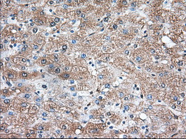 TS / Thromboxane Synthase Antibody - IHC of paraffin-embedded Human liver tissue using anti-TBXAS1 mouse monoclonal antibody. (Dilution 1:50).
