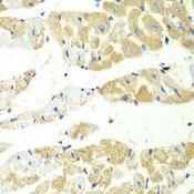 TS / Thromboxane Synthase Antibody - Immunohistochemistry of paraffin-embedded mouse heart using TBXAS1 antibody at dilution of 1:100 (40x lens).