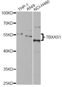 TS / Thromboxane Synthase Antibody - Western blot analysis of extracts of various cell lines, using TBXAS1 antibody at 1:1000 dilution. The secondary antibody used was an HRP Goat Anti-Rabbit IgG (H+L) at 1:10000 dilution. Lysates were loaded 25ug per lane and 3% nonfat dry milk in TBST was used for blocking. An ECL Kit was used for detection and the exposure time was 60s.