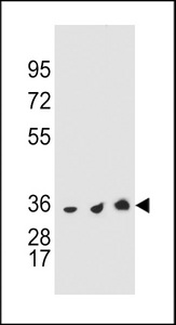 TS / Thymidylate Synthase Antibody - TYSY Antibody western blot of HeLa,Jurkat and HL-60 cell line lysates (35 ug/lane). The TYSY antibody detected the TYSY protein (arrow).