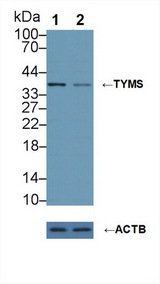 TS / Thymidylate Synthase Antibody - Knockout Varification: Lane 1: Wild-type U2OS cell lysate; Lane 2: TYMS knockout U2OS cell lysate; Predicted MW: 36,32,26kd Observed MW: 38kd Primary Ab: 1µg/ml Rabbit Anti-Human TYMS Antibody Second Ab: 0.2µg/mL HRP-Linked Caprine Anti-Rabbit IgG Polyclonal Antibody