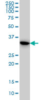TS / Thymidylate Synthase Antibody - TYMS monoclonal antibody (M01), clone 3A1 Western blot of TYMS expression in HeLa.