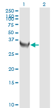 TS / Thymidylate Synthase Antibody - Western blot of TYMS expression in transfected 293T cell line by TYMS monoclonal antibody (M01), clone 3A1.