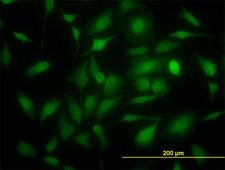 TS / Thymidylate Synthase Antibody - Immunofluorescence of monoclonal antibody to TYMS on HeLa cell. [antibody concentration 20 ug/ml]