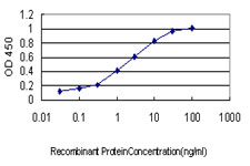 TS / Thymidylate Synthase Antibody - Detection limit for recombinant GST tagged TYMS is approximately 0.03 ng/ml as a capture antibody.