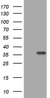 TS / Thymidylate Synthase Antibody - HEK293T cells were transfected with the pCMV6-ENTRY control (Left lane) or pCMV6-ENTRY TYMS (Right lane) cDNA for 48 hrs and lysed. Equivalent amounts of cell lysates (5 ug per lane) were separated by SDS-PAGE and immunoblotted with anti-TYMS.