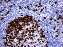 TS / Thymidylate Synthase Antibody - IHC of paraffin-embedded Human tonsil using anti-TYMS mouse monoclonal antibody.
