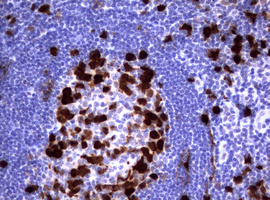 TS / Thymidylate Synthase Antibody - IHC of paraffin-embedded Human tonsil using anti-TYMS mouse monoclonal antibody.