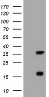 TS / Thymidylate Synthase Antibody - HEK293T cells were transfected with the pCMV6-ENTRY control (Left lane) or pCMV6-ENTRY TYMS (Right lane) cDNA for 48 hrs and lysed. Equivalent amounts of cell lysates (5 ug per lane) were separated by SDS-PAGE and immunoblotted with anti-TYMS.