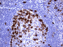 TS / Thymidylate Synthase Antibody - IHC of paraffin-embedded Human tonsil using anti-TYMS mouse monoclonal antibody.