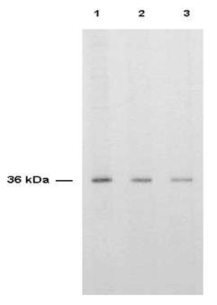 TS / Thymidylate Synthase Antibody - Anti-TS is shown to detect thymidylate synthase present in a HeLa cell extract. Each lane is estimated to contain 4 mg of protein. Lanes 1, 2 and 3 represent 1:500, 1:1000 and 1:2000 fold dilutions of the antibody.