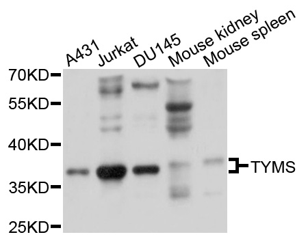 TS / Thymidylate Synthase Antibody - Western blot analysis of extracts of various cell lines, using TYMS antibody at 1:1000 dilution. The secondary antibody used was an HRP Goat Anti-Rabbit IgG (H+L) at 1:10000 dilution. Lysates were loaded 25ug per lane and 3% nonfat dry milk in TBST was used for blocking. An ECL Kit was used for detection and the exposure time was 3s.