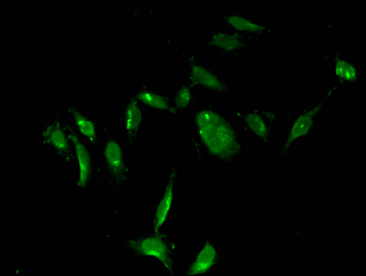 TS / Thymidylate Synthase Antibody - Immunofluorescent analysis of Hela cells using TYMS Antibody at a dilution of 1:100 and Alexa Fluor 488-congugated AffiniPure Goat Anti-Rabbit IgG(H+L)