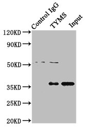 TS / Thymidylate Synthase Antibody - Immunoprecipitating TYMS in Hela whole cell lysate Lane 1: Rabbit control IgG instead of TYMS Antibody in Hela whole cell lysate.For western blotting, a HRP-conjugated Protein G antibody was used as the secondary antibody (1/2000) Lane 2: TYMS Antibody (8µg) + Hela whole cell lysate (500µg) Lane 3: Hela whole cell lysate (10µg)