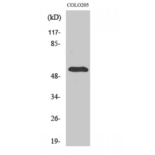 TSAP6 / STEAP3 Antibody - Western blot of pHyde antibody
