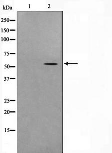 TSAP6 / STEAP3 Antibody - Western blot analysis on COLO205 cell lysates using STEA3 antibody. The lane on the left is treated with the antigen-specific peptide.