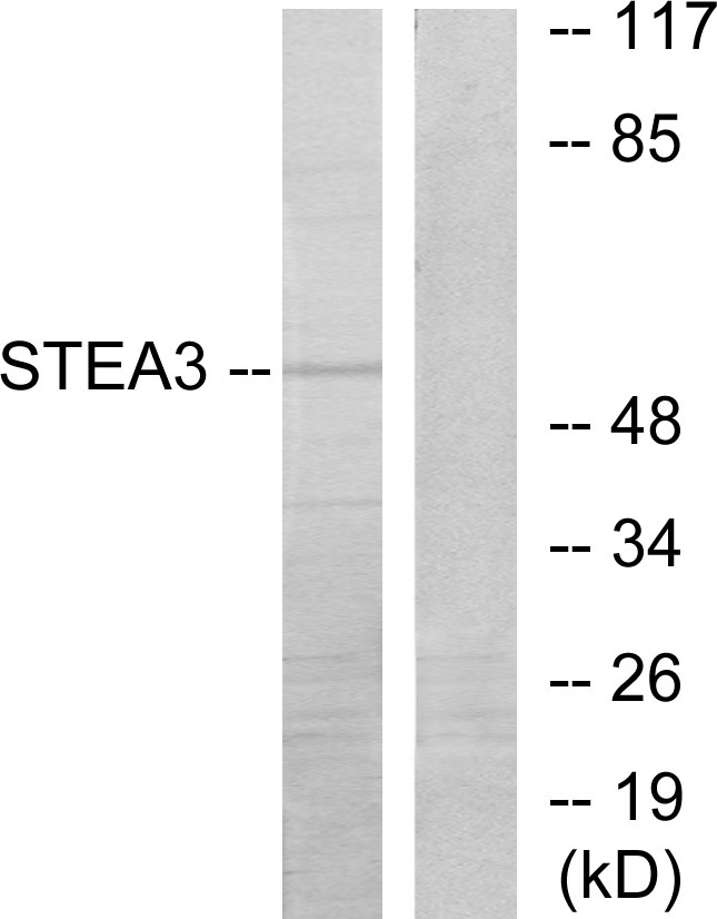 TSAP6 / STEAP3 Antibody - Western blot analysis of lysates from COLO205 cells, using STEA3 Antibody. The lane on the right is blocked with the synthesized peptide.