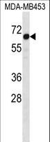 TSAP6 / STEAP3 Antibody - STEAP3 Antibody western blot of MDA-MB453 cell line lysates (35 ug/lane). The STEAP3 antibody detected the STEAP3 protein (arrow).