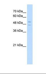 TSAP6 / STEAP3 Antibody - HepG2 cell lysate. Antibody concentration: 5.0 ug/ml. Gel concentration: 12%.  This image was taken for the unconjugated form of this product. Other forms have not been tested.