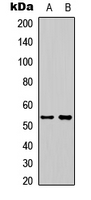 TSAP6 / STEAP3 Antibody - Western blot analysis of STEAP3 expression in HeLa (A); HepG2 (B) whole cell lysates.