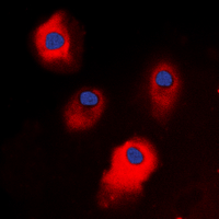 TSAP6 / STEAP3 Antibody - Immunofluorescent analysis of STEAP3 staining in HepG2 cells. Formalin-fixed cells were permeabilized with 0.1% Triton X-100 in TBS for 5-10 minutes and blocked with 3% BSA-PBS for 30 minutes at room temperature. Cells were probed with the primary antibody in 3% BSA-PBS and incubated overnight at 4 deg C in a humidified chamber. Cells were washed with PBST and incubated with a DyLight 594-conjugated secondary antibody (red) in PBS at room temperature in the dark. DAPI was used to stain the cell nuclei (blue).