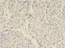TSAP6 / STEAP3 Antibody - Immunohistochemistry of paraffin-embedded human pancreas tissue using antibody at 1:100 dilution.