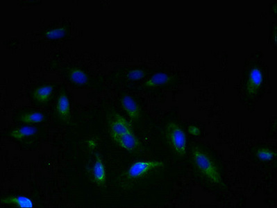 TSAP6 / STEAP3 Antibody - Immunofluorescent analysis of Hela cells using STEAP3 Antibody at dilution of 1:100 and Alexa Fluor 488-congugated AffiniPure Goat Anti-Rabbit IgG(H+L)