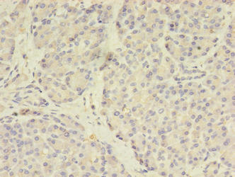TSAP6 / STEAP3 Antibody - Immunohistochemistry of paraffin-embedded human pancreatic tissue using STEAP3 Antibody at dilution of 1:100