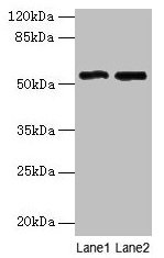 TSAP6 / STEAP3 Antibody - Western blot All lanes: STEAP3 antibody at 24µg/ml Lane 1: HepG2 whole cell lysate Lane 2: Hela whole cell lysate Secondary Goat polyclonal to rabbit IgG at 1/10000 dilution Predicted band size: 55, 56, 51 kDa Observed band size: 55 kDa