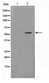 TSAP6 / STEAP3 Antibody - Western blot of COLO205 cell lysate using STEA3 Antibody