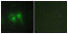 TSAP6 / STEAP3 Antibody - Peptide - + Immunofluorescence analysis of HeLa cells, using STEA3 antibody.