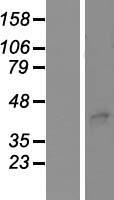 TSAP6 / STEAP3 Protein - Western validation with an anti-DDK antibody * L: Control HEK293 lysate R: Over-expression lysate