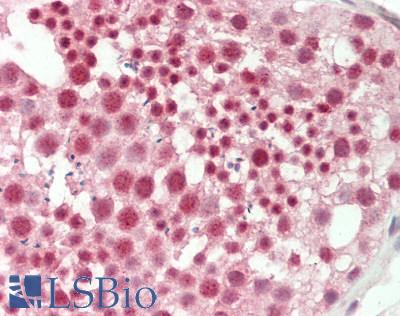 TSC22D1 / TSC22 Antibody - Human Testis: Formalin-Fixed, Paraffin-Embedded (FFPE).  This image was taken for the unconjugated form of this product. Other forms have not been tested.