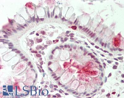 TSC22D1 / TSC22 Antibody - Human Colon: Formalin-Fixed, Paraffin-Embedded (FFPE).  This image was taken for the unconjugated form of this product. Other forms have not been tested.