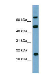 TSC22D1 / TSC22 Antibody - TSC22D1 antibody Lestern blot of ACHN cell lysate.  This image was taken for the unconjugated form of this product. Other forms have not been tested.