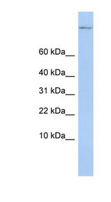 TSC22D1 / TSC22 Antibody - TSC22D1 antibody Western blot of MCF7 cell lysate. This image was taken for the unconjugated form of this product. Other forms have not been tested.