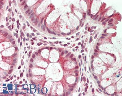 TSC22D1 / TSC22 Antibody - Human Colon: Formalin-Fixed, Paraffin-Embedded (FFPE).  This image was taken for the unconjugated form of this product. Other forms have not been tested.