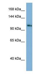 TSC22D1 / TSC22 Antibody - TSC22D1 / TSC22 antibody Western Blot of Human Spleen.  This image was taken for the unconjugated form of this product. Other forms have not been tested.